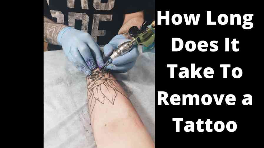 How Long Does It Take To Remove a Tattoo | Book Dr Online