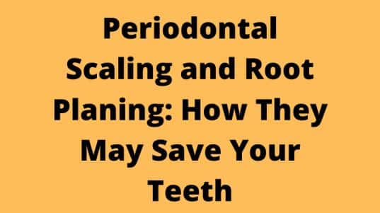 Periodontal Scaling and Root Planing: How They May Save Your Teeth