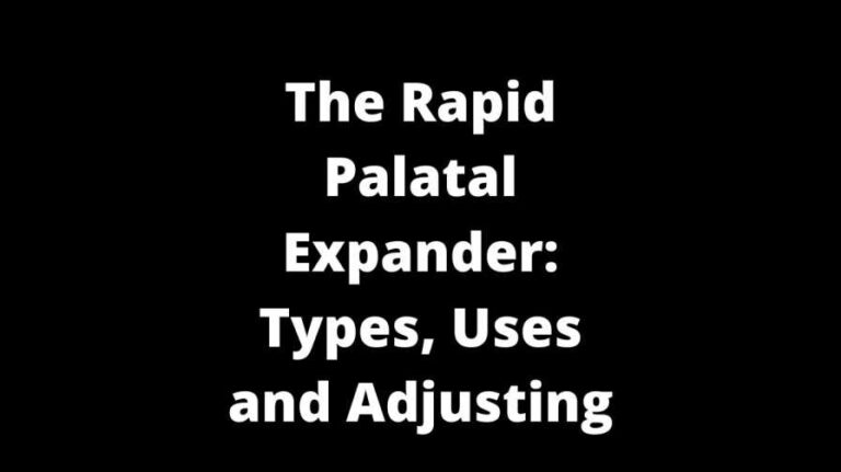 The Rapid Palatal Expander: Types, Uses and Adjusting