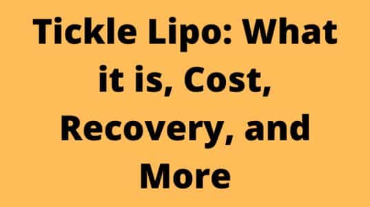 Tickle Lipo: What it is, Cost, Recovery, and More