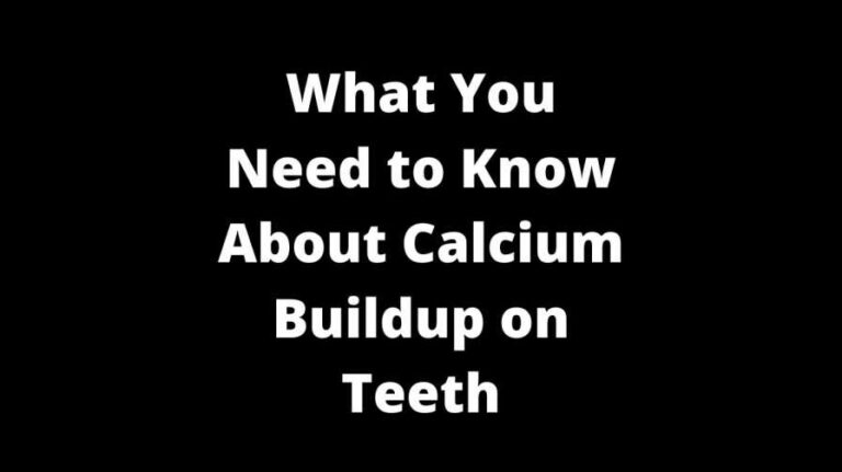 What You Need to Know About Calcium Buildup on Teeth